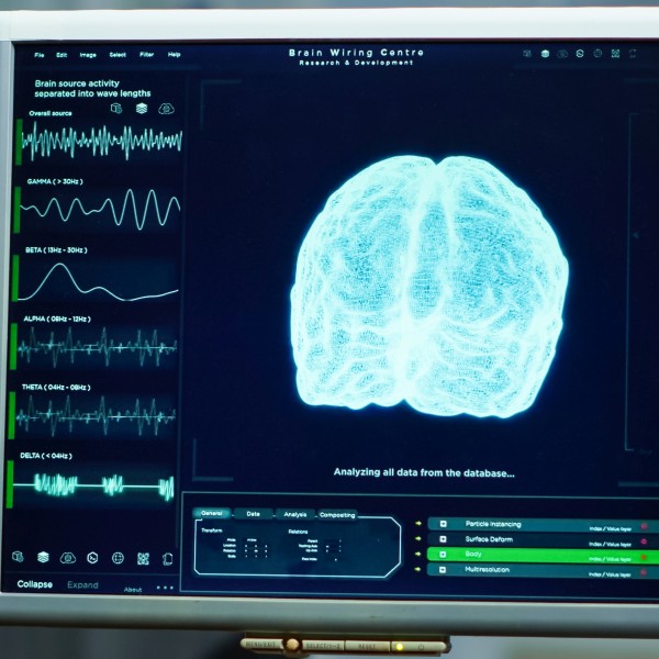 Epilepszia szakrendelés